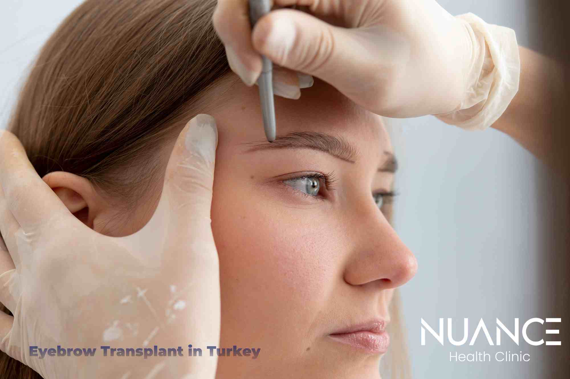 Eyebrow Transplant in Turkey