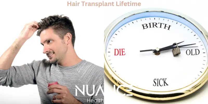 hair-transplant lifetime in Turkey