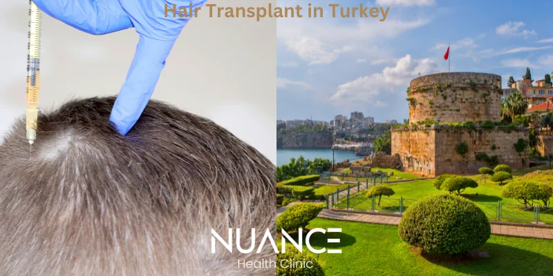 Hair Transplant in Turkey