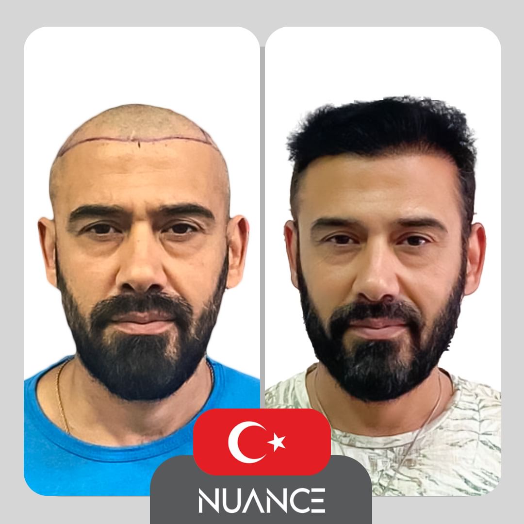 Nuance Health Clinic - Before after image