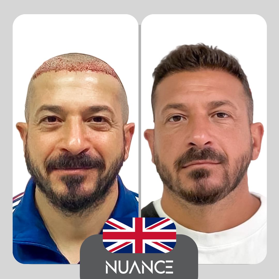 Nuance Health Clinic - Before after image
